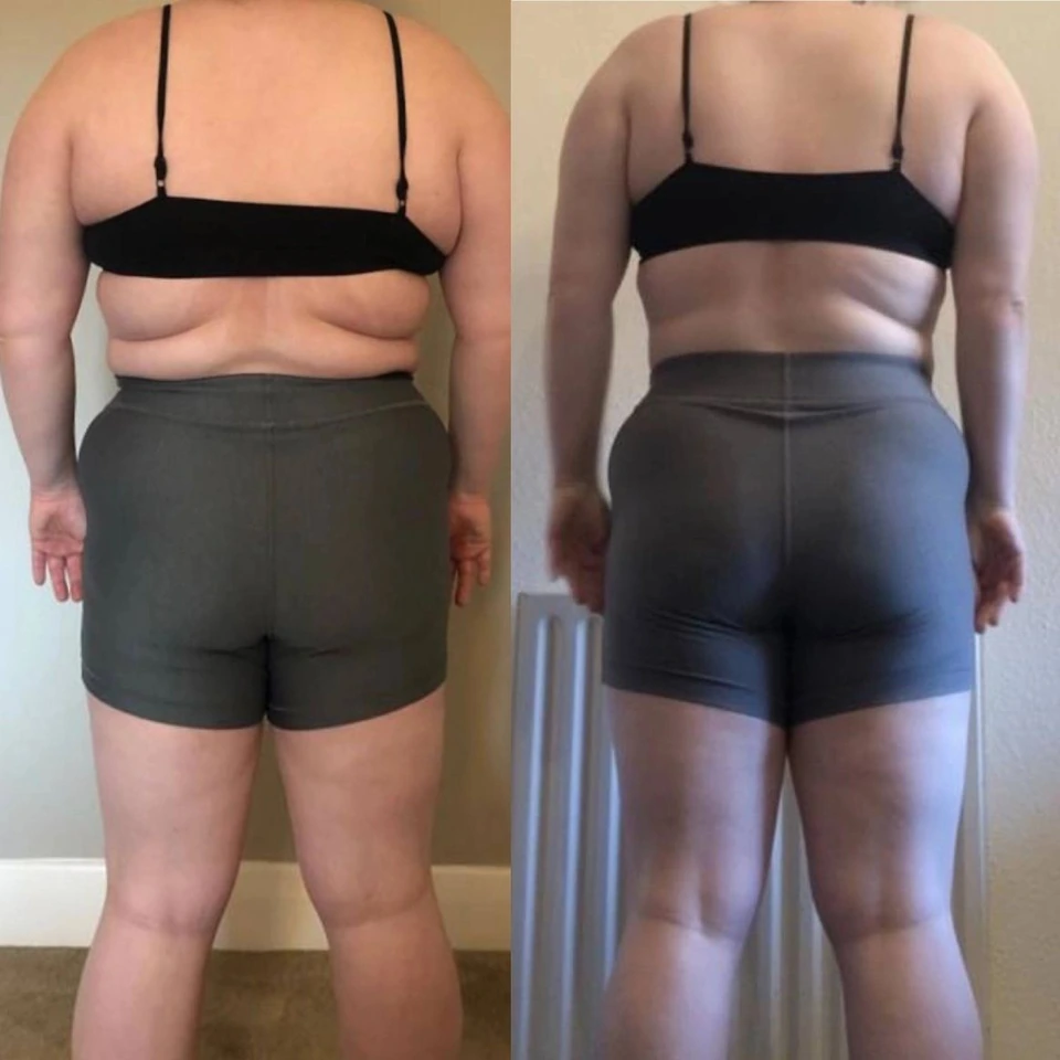Emma’s before and after photographs showing changes in body composition
